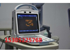 便携式电子凸阵B型超声诊断仪生产厂家图2